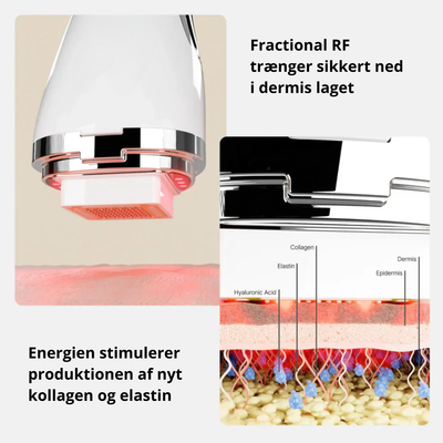 NOVASKIN™ RF Hudbehandler