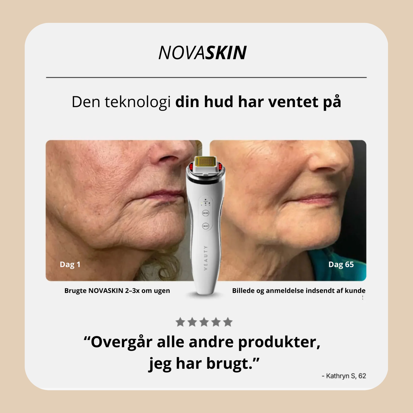 NOVASKIN™ RF Hudbehandler